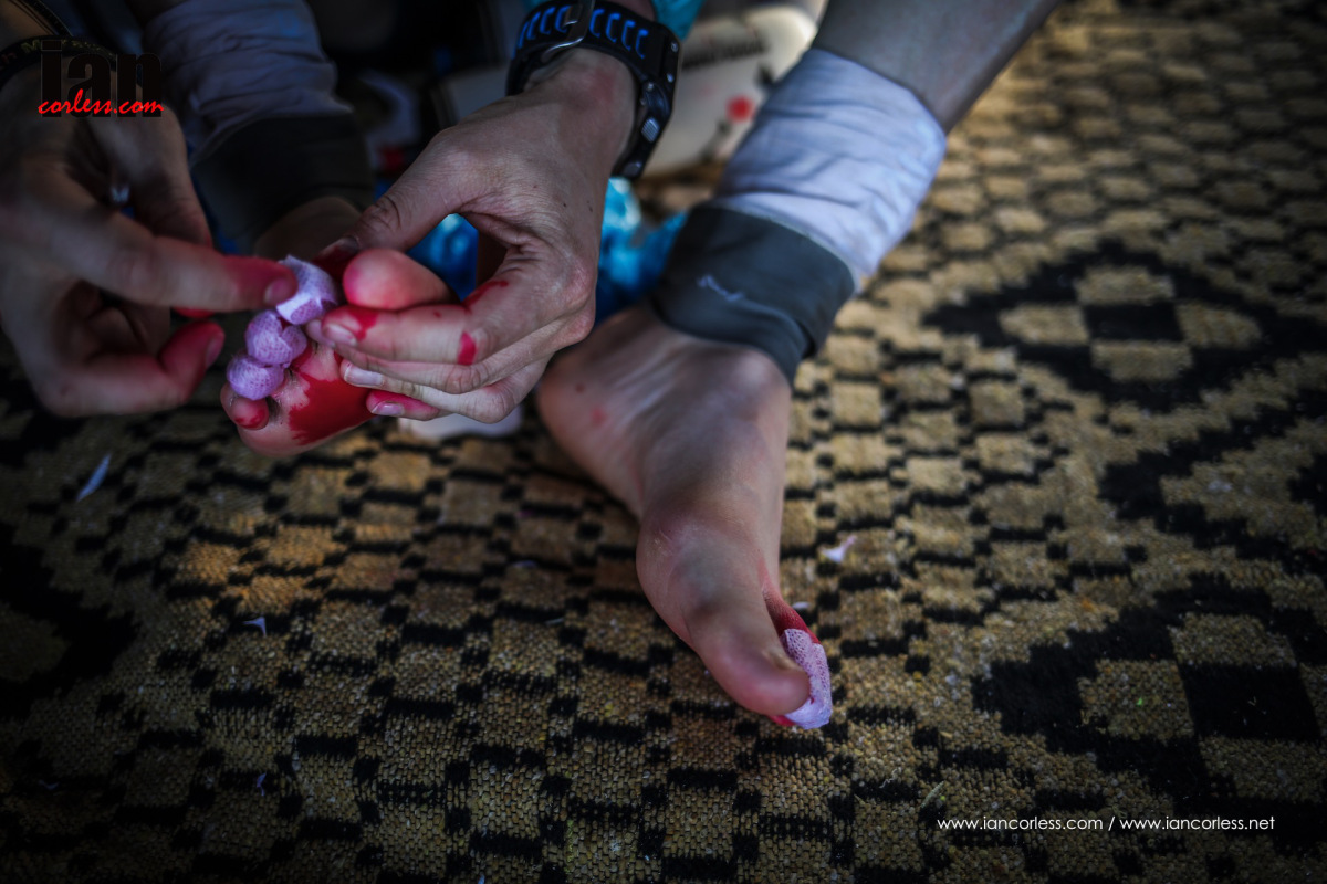 Marathon des Sables foot preparation blister taping